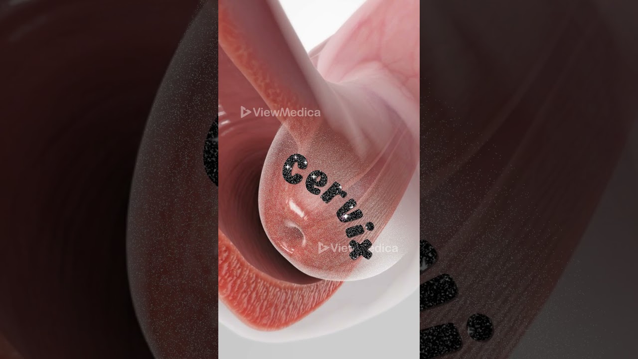 Pap Smear 3D Animation: Early Detection of Cervical Changes