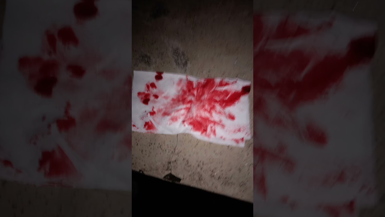 Nanti Aku Ceritain Kalau Kamu Like ๐