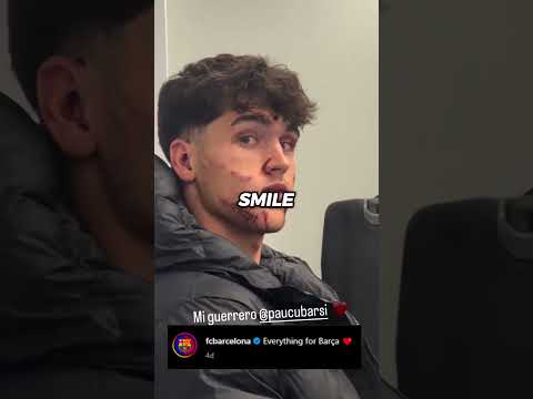 PAU CUBARSI WITH 10 STITCHES ON HIS FACE TAKES THE FIELD DESPITE IT 😳 A REAL GLADIATOR 🛡️⚔️