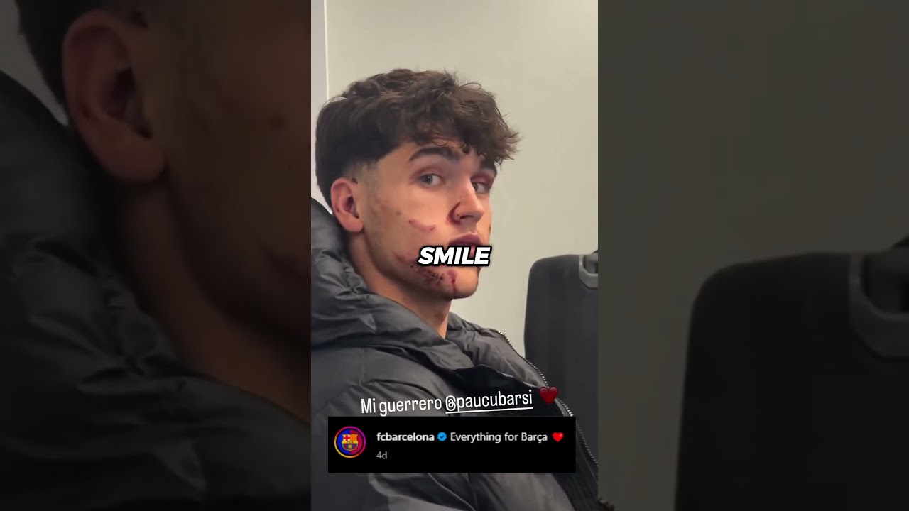 Incredible Resilience: PAU CUBARSI Battles on Field with 10 Stitches on His Face 😳