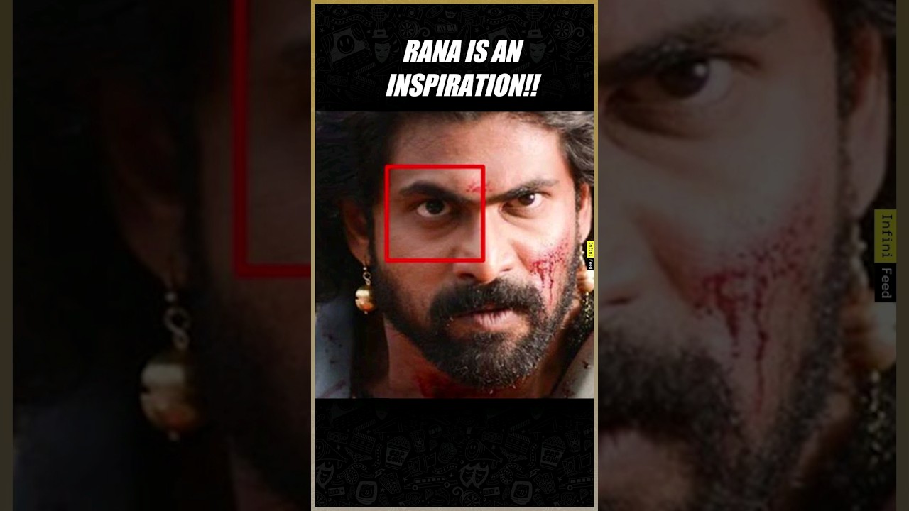 Rana Daggubati's Vision Issue | Bahubali & More