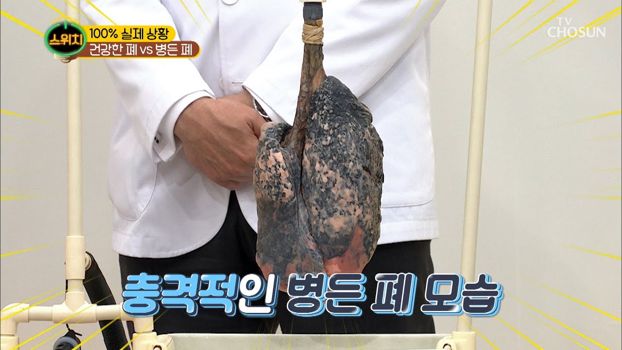 충격 실화! 병든 폐와 건강한 폐의 차이와 담배의 위험 🚭