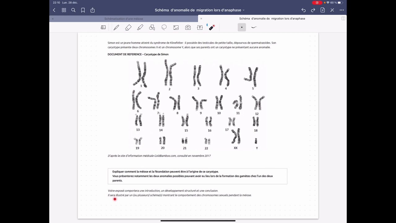 BAC SVT Génomique : Correction Trisomie 🧬
