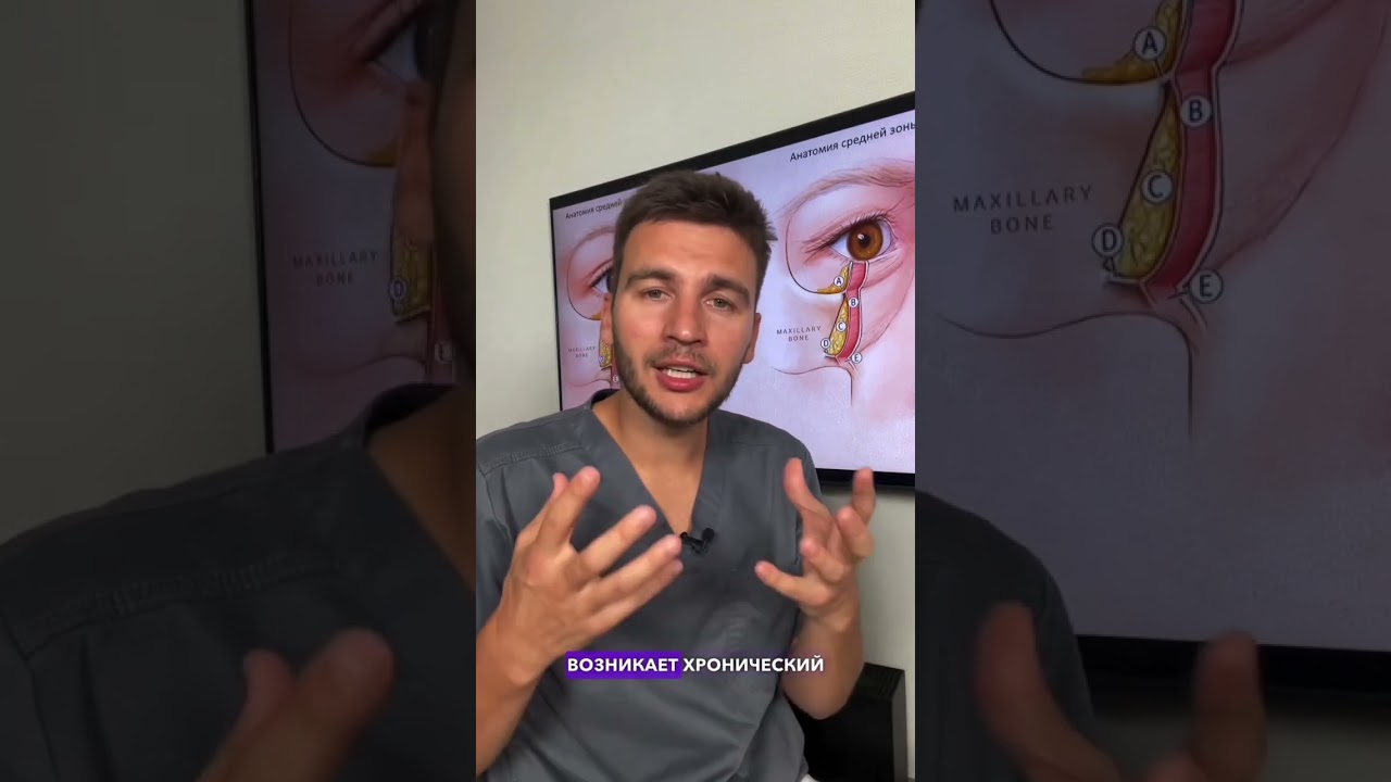 Почему появляются мешки под глазами?