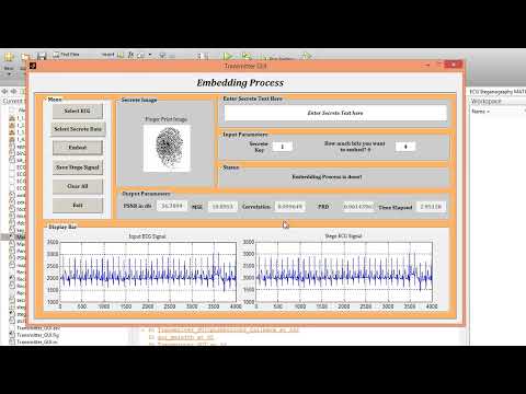 MATLAB code of Curvelet Based ECG Steganography for Privacy Protection