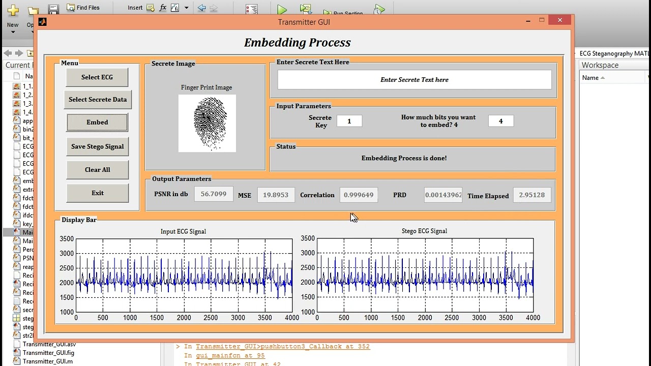 Secure Your ECG Data with MATLAB Curvelet-Based Steganography 🔒