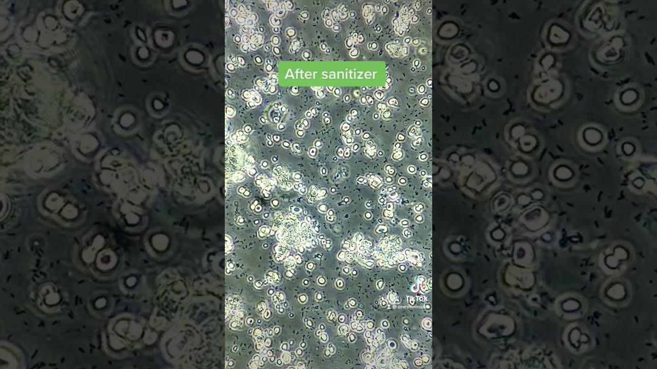 Microscopic Showdown: Bacteria vs. Hand Sanitizer 🧪