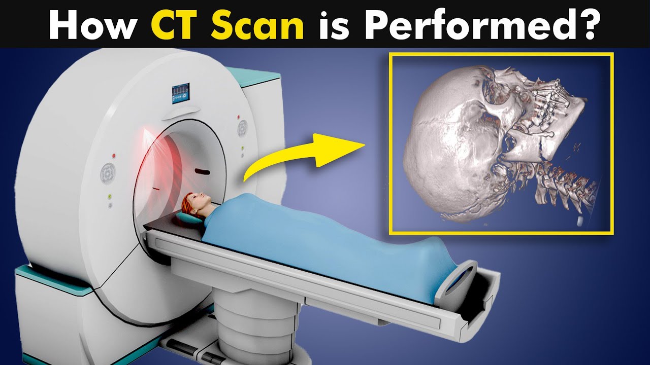 Understanding CT Scan: What It Is & How It's Done 🩻