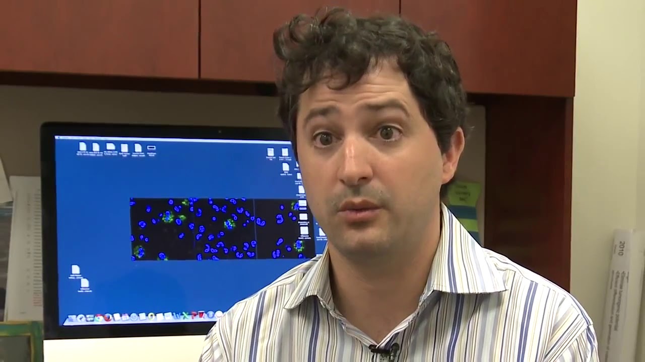 At the NIH Clinical Center: Dr. Peter Grayson studies vasculitis C inflammation of blood cells