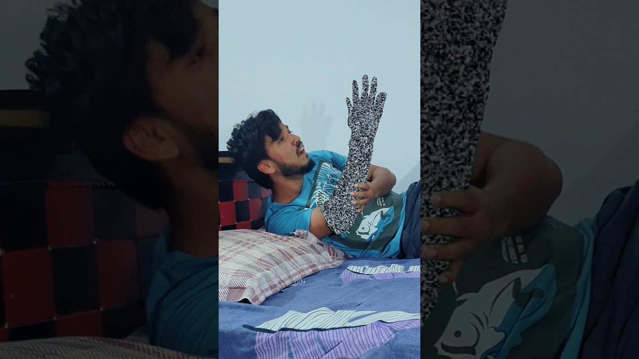 Hand Connection Lost 😂