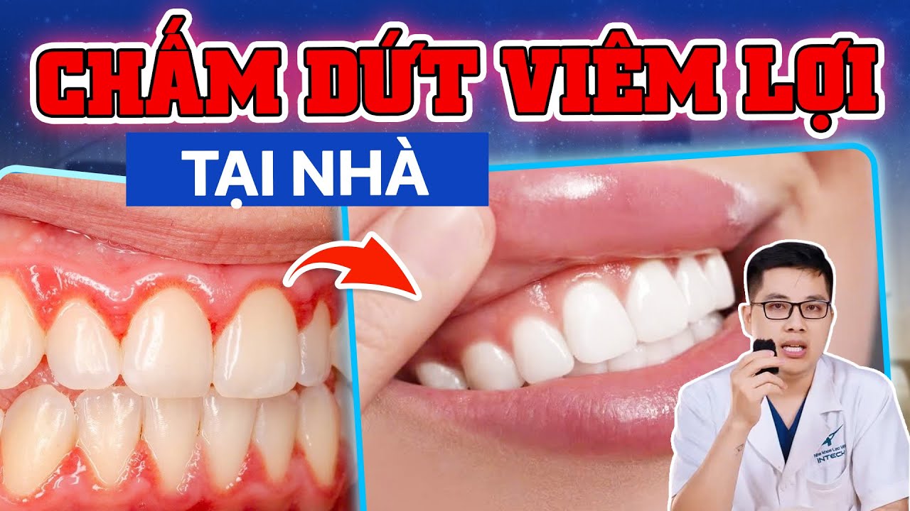 Chữa Viêm Lợi Tại Nhà Hiệu Quả Với 3 Cách Đơn Giản 🌿