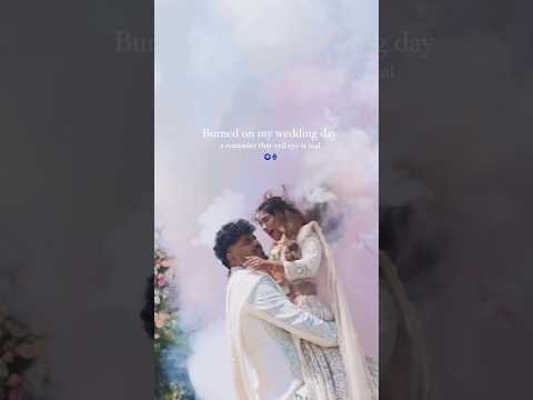 Bride BURNT on wedding day | Evil Eyes š§æ #wedding #bride #accident #viralvideo #viralshorts #insta