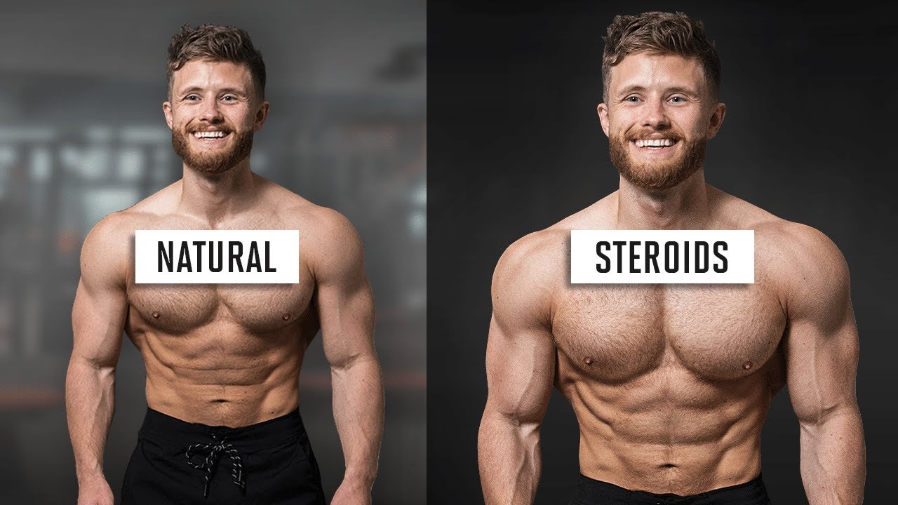 Muscle Gains: Natural vs Steroid Use 💪