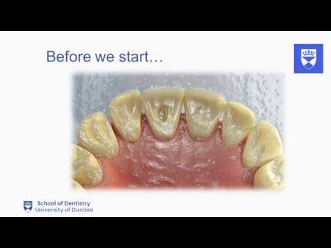 Endodontic Treatment of Single-Rooted Tooth: Part 2 🦷