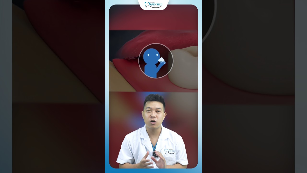 Sau Nhổ Răng Khôn Không Nên Ăn Gì | Nha Khoa Minh Châu