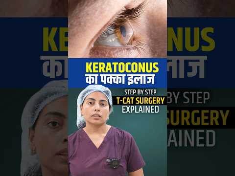 Keratoconus Treatment | T-Cat + C3R Procedure
