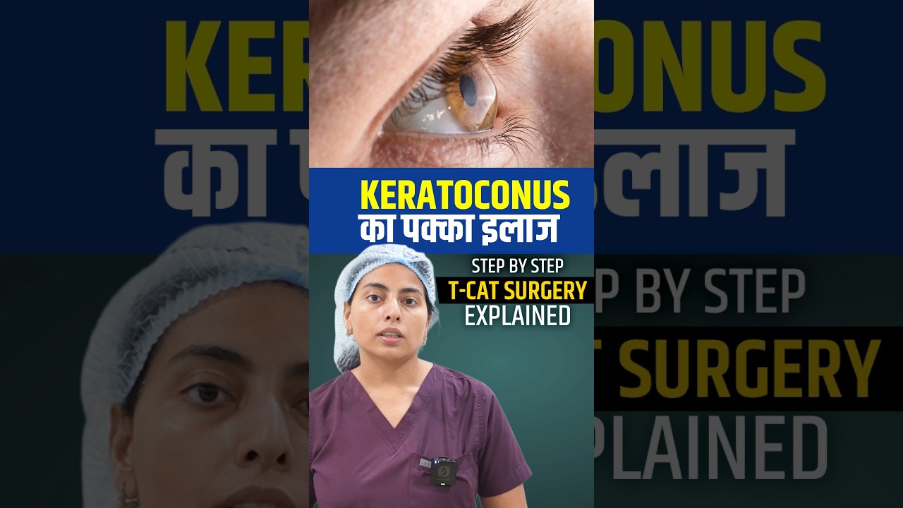 Effective Keratoconus Treatment: T-Cat + C3R Procedure Explained by Dr. Gunjan Budhiraja 👁️