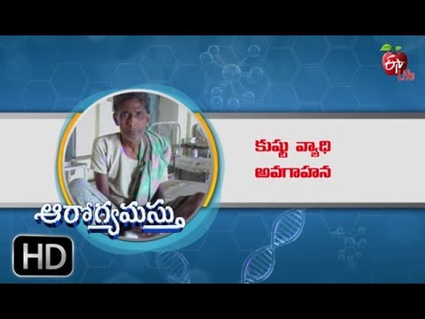 World Leprosy Day | Aarogyamastu | Jan 25, 2019