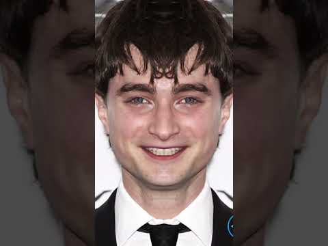 Eye Misalignment (BVD) ➡️ Poor depth & spatial perception ➡️ Poor coordination ➡️ Dyspraxia (Clumsin