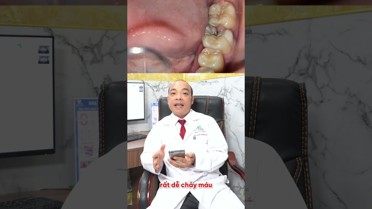 Viêm Nướu Có Nguy Hiểm Không? 🦷