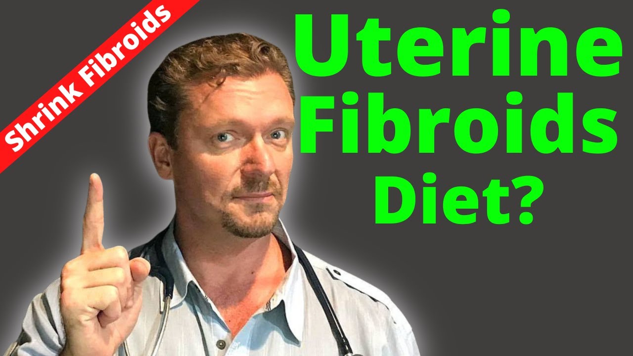Shrink Fibroids Naturally in 2026 🩺