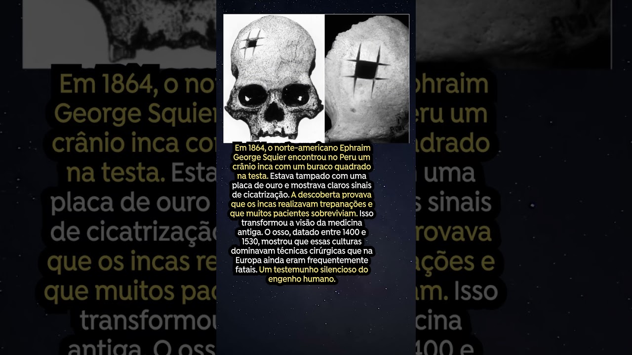 Crânio Inca com Segredo Revelado: A Sabedoria Antiga do Peru 🧠