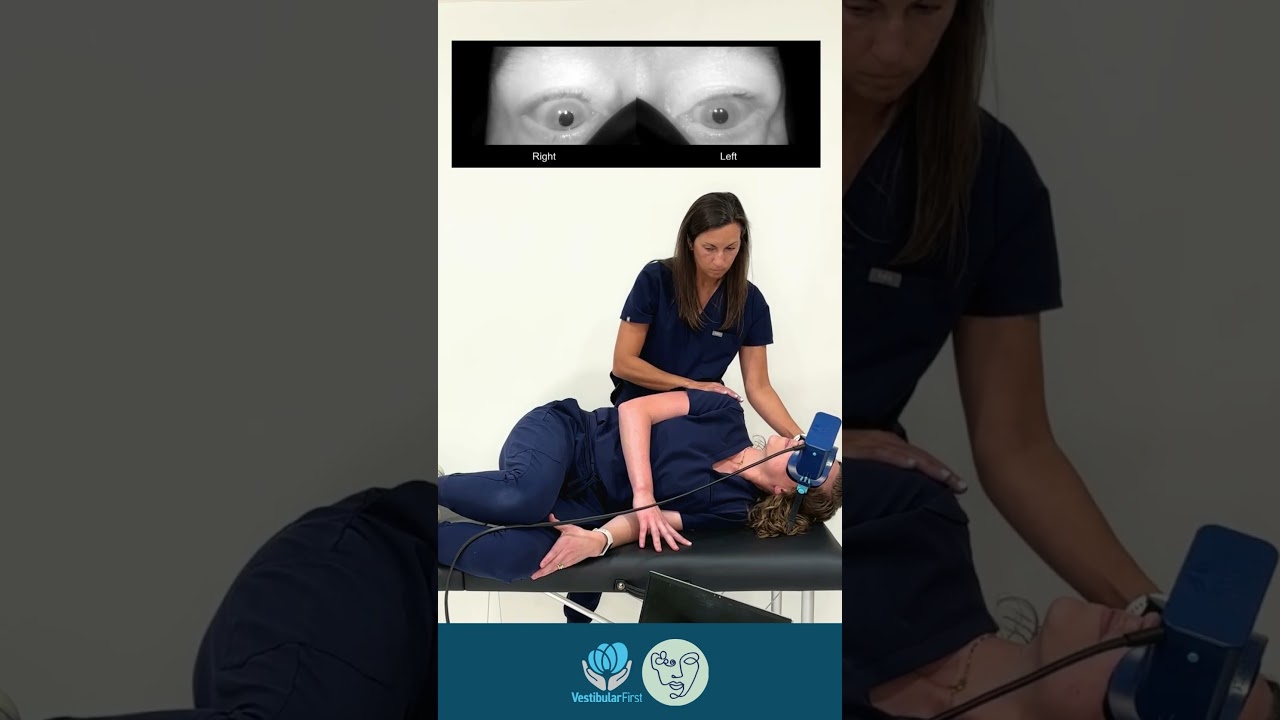 Side Lying Test for Left Posterior Canal BPPV 🌀