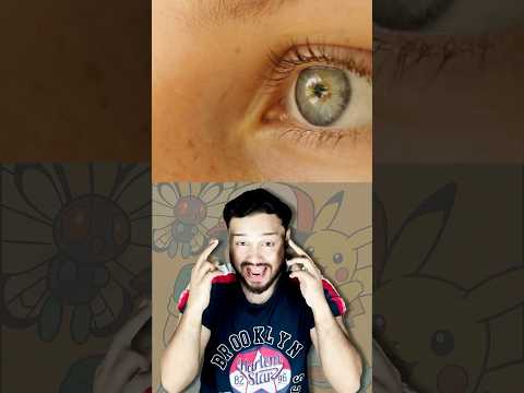 Why People Got SICK After âWatching An Episodeâ of Pokemon #shorts