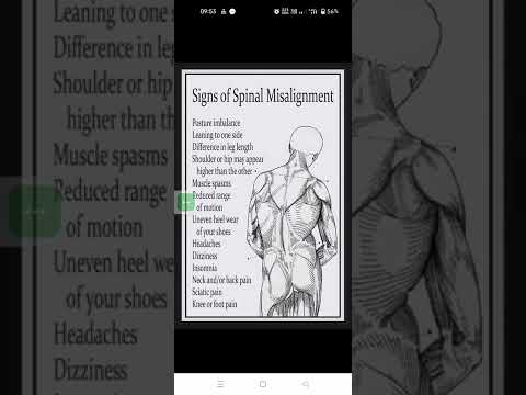 signs of spinal misalignment every one to know