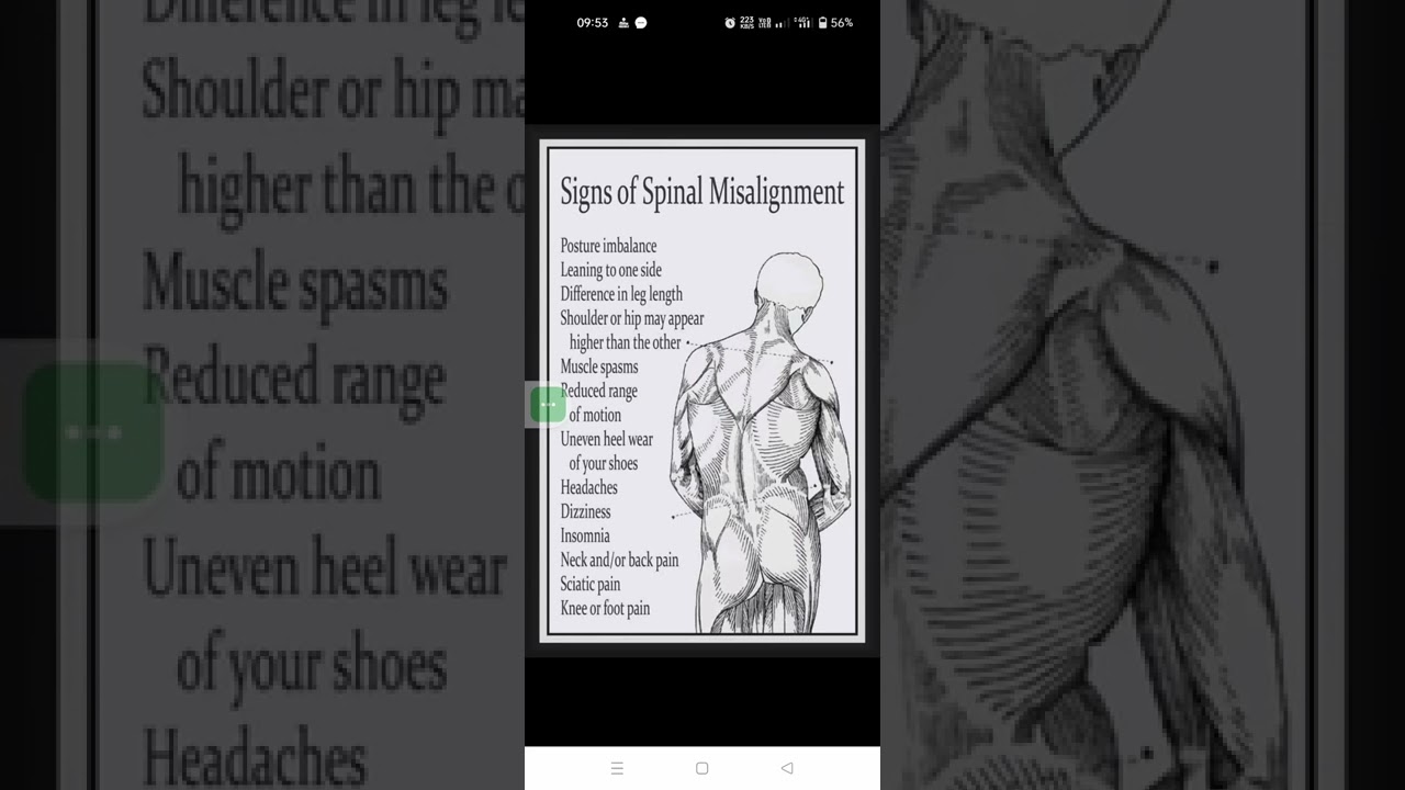 Signs of Spinal Misalignment Everyone Should Know