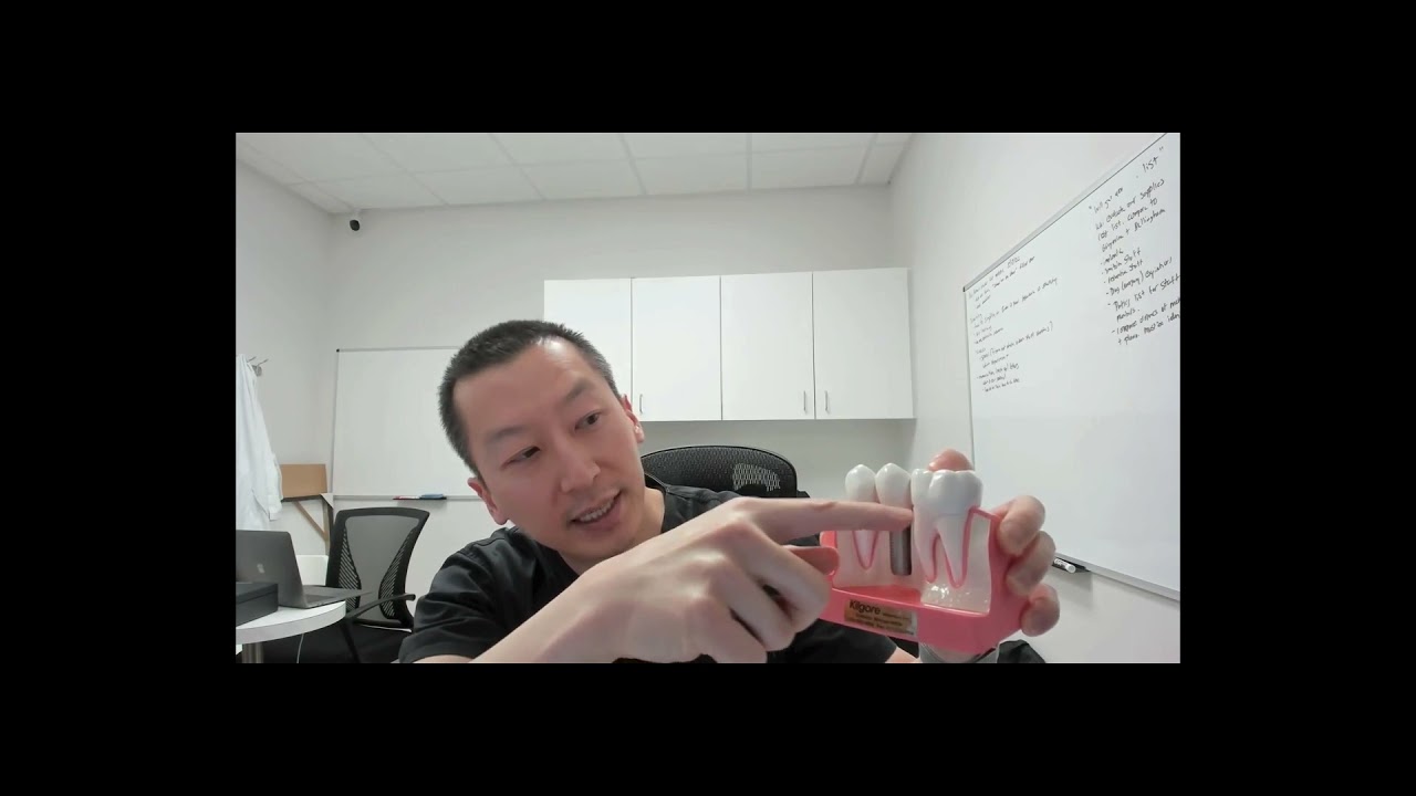 Before Getting a Dental Crown: What to Know 🦷