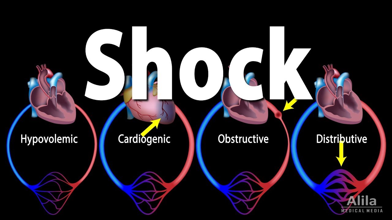Circulatory Shock Types & Pathology 🩺