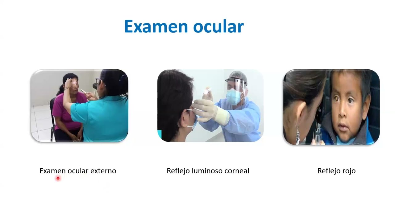 Evaluación de la Agudeza Visual con la Cartilla de Snellen - Registro HIS