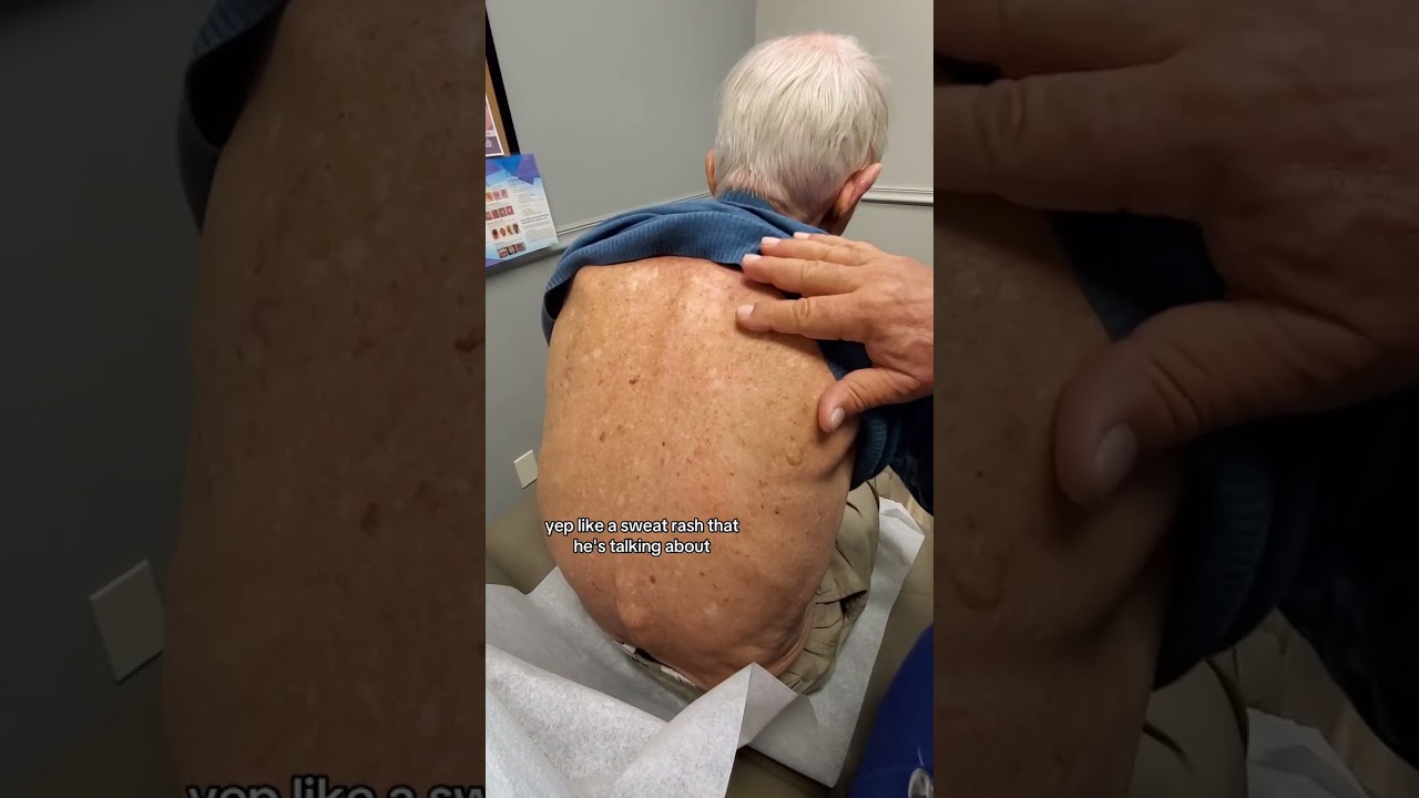 Dermatologist with 50 Years Experience Examines Patient in Clinic π¨π»ββοΈ #dermatology #derm