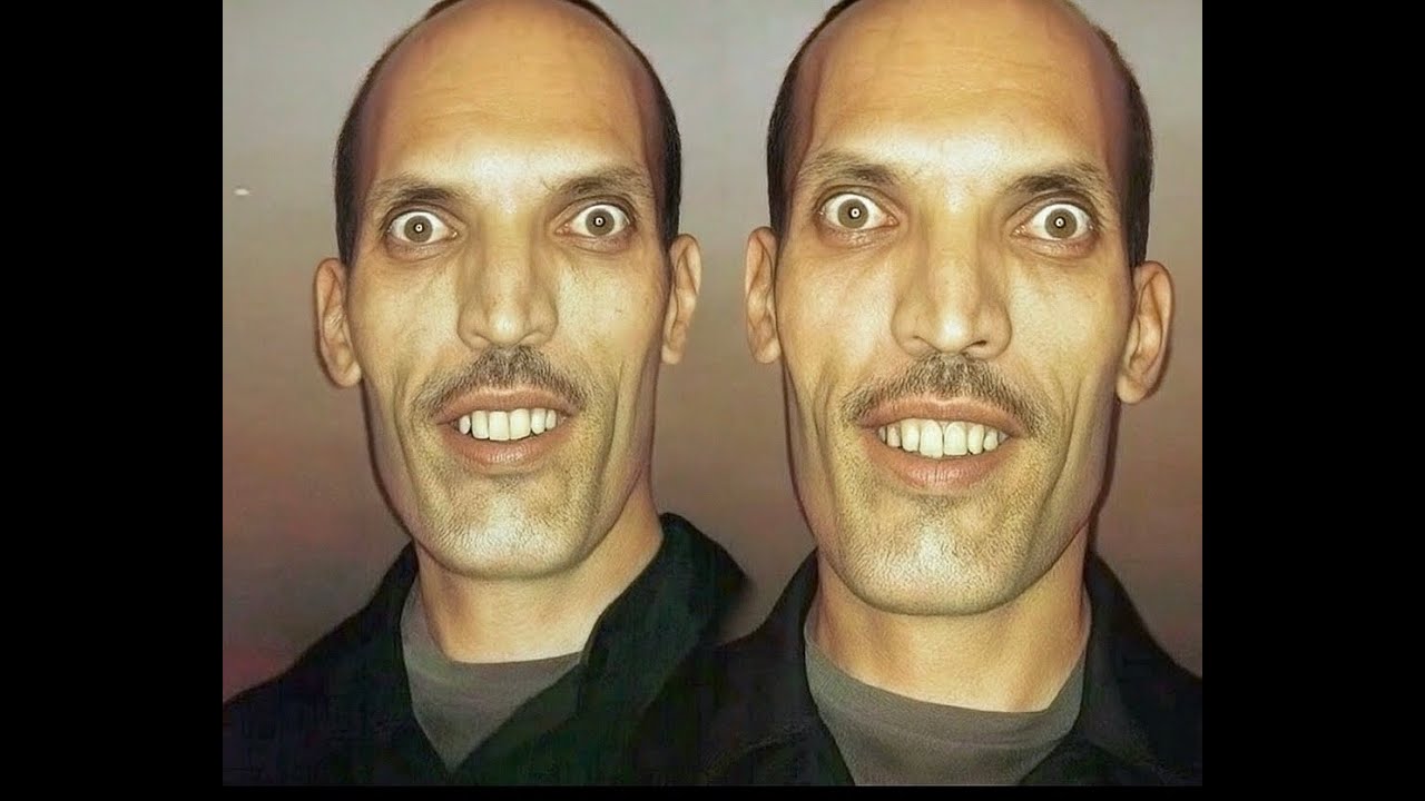 Alex Kartela - Bliznacite Diss | New Track 2025 🎶