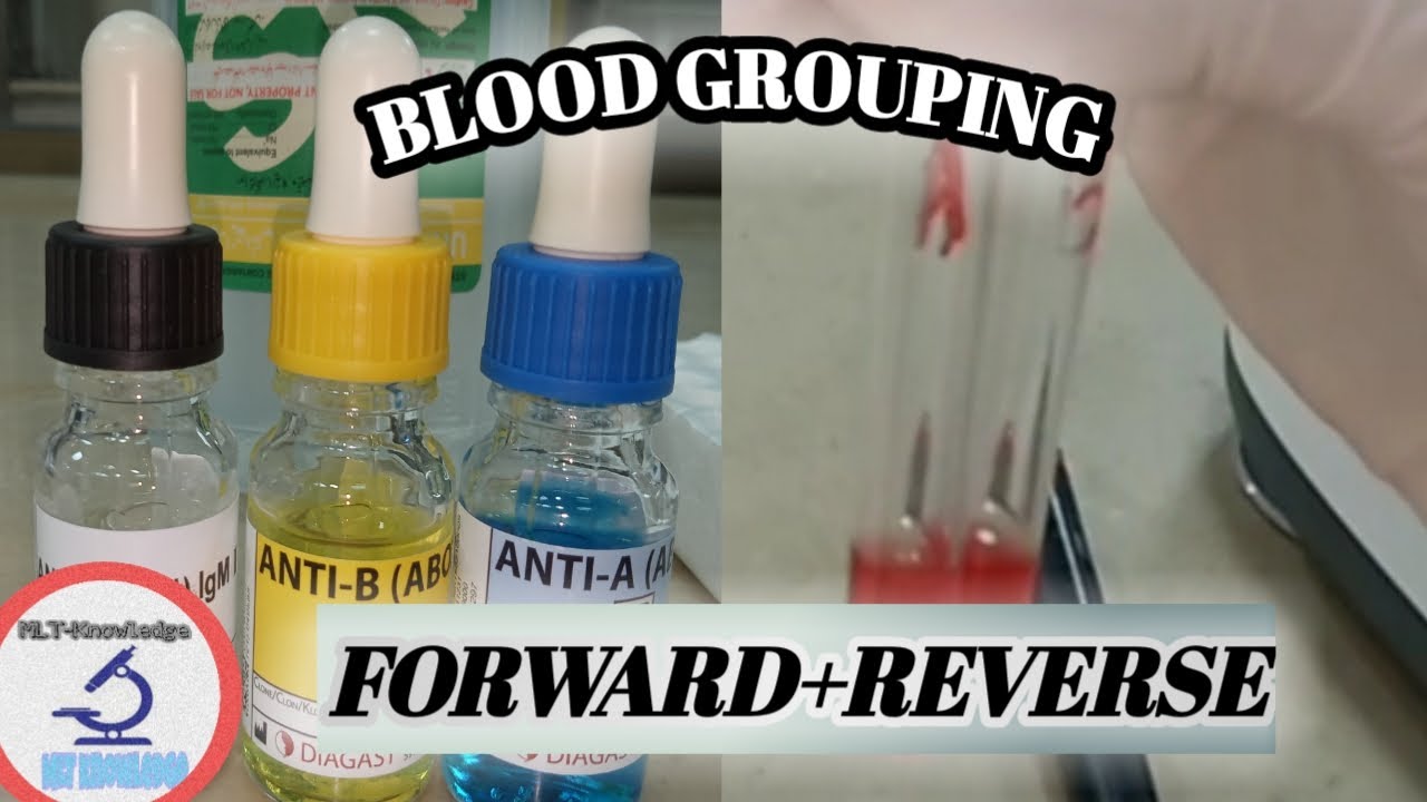Forward and Reverse Blood Typing Using the Tube Method