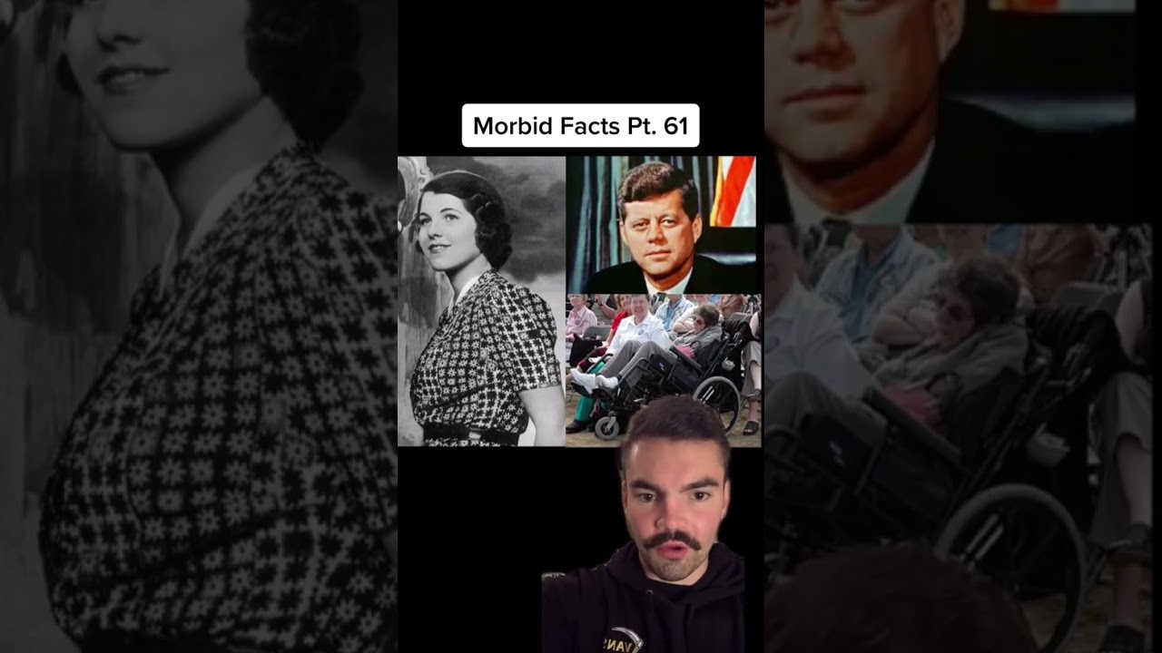 Rosemary Kennedy's Tragic Lobotomy 😢