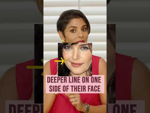 Stop 🛑 the Asymmetric Smile Lines with face exercises