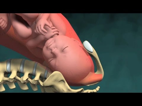 Normal Vaginal Childbirth: Free Medical Animations 🎥