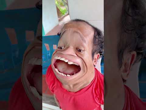 The Pain 😵‍💫