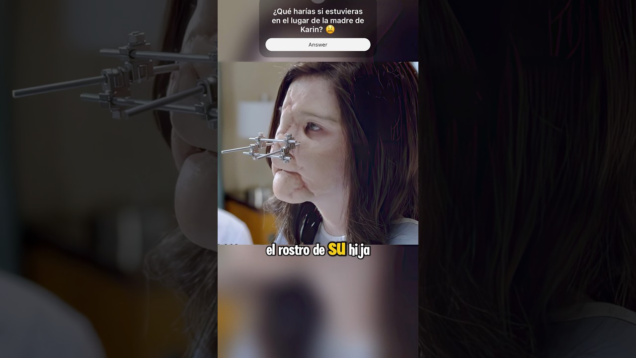 Chica con cara de chicle tras herida de bala 😱