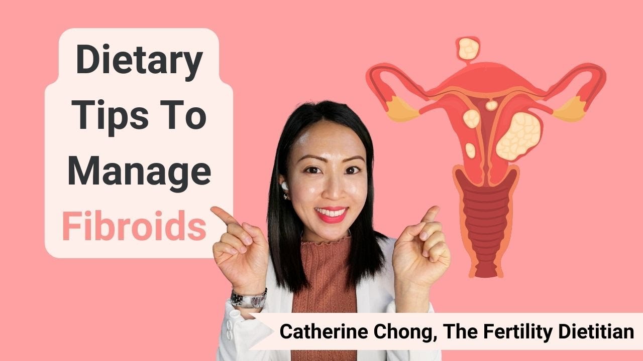 Struggling with Fibroids? The Diet Changes That Can Help Reduce Symptoms