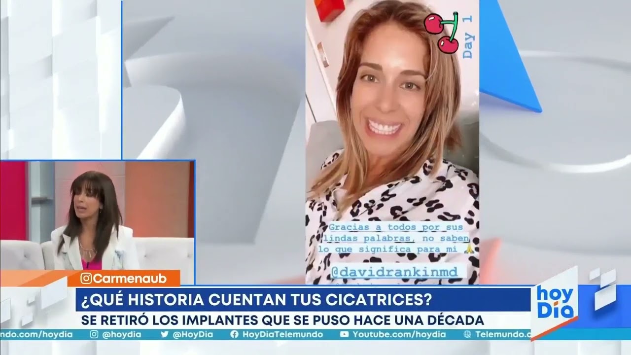 Carmen Aub se retira los implantes tras 10 años