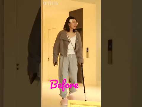 Zhao Lusi Before vs Now | Health Condition 💫🥰