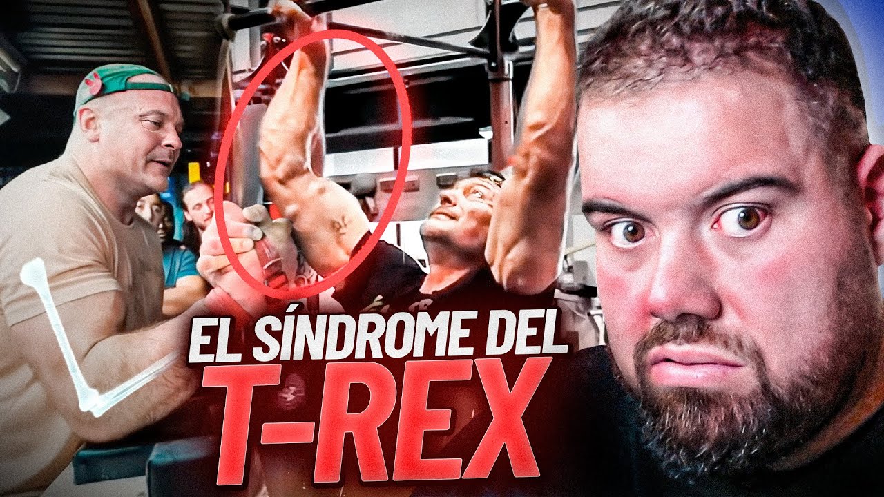 ¿Por qué los armwrestlers no pueden estirar el brazo? 🤔