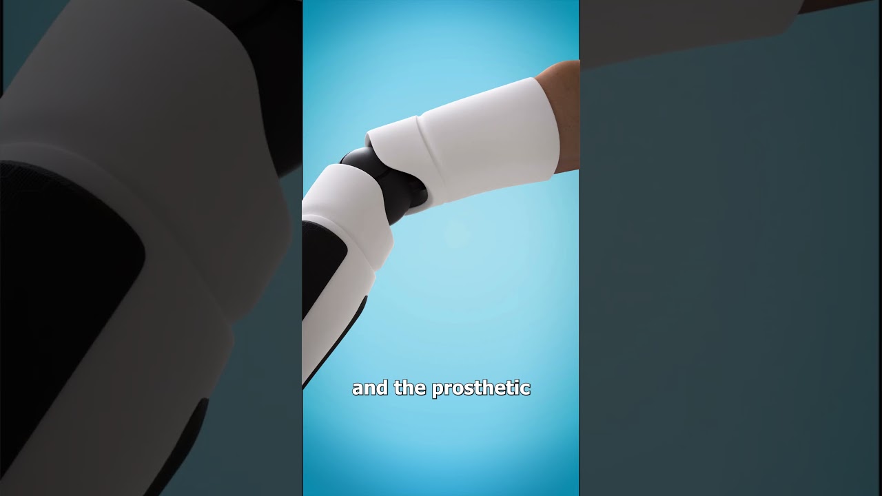 How a Bionic Arm Works 🤖
