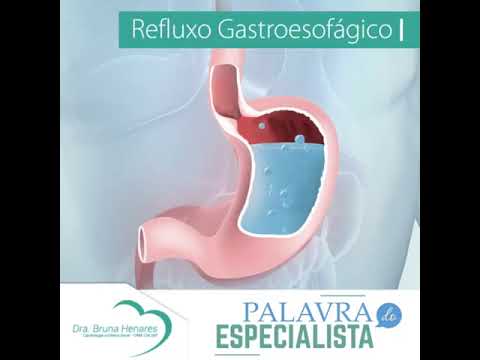Refluxo Gastroesofágico