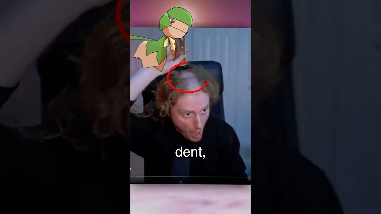 Headset Dent Tier List