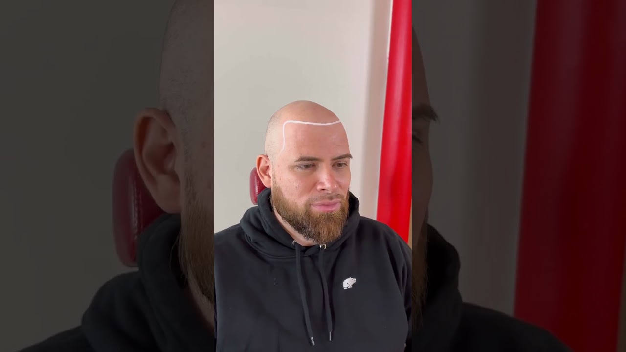 Amazing Hair Transformation with SMP ✨