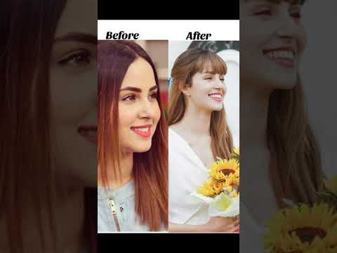 Pakistani actress before and after Kon si actress cute 🥰 lagh Rahi Hy